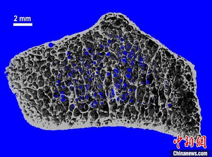 国际最新研究：宇航员在太空增加抗阻锻炼或助减少骨量损失